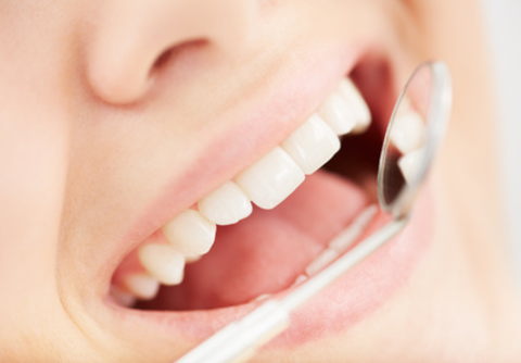 歯を失わない虫歯治療